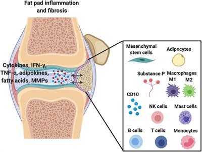 Frontiers Infrapatellar Fat Pad Synovium Complex In Early Stage Knee Osteoarthritis Potential New Target And Source Of Therapeutic Mesenchymal Stem Stromal Cells Bioengineering And Biotechnology