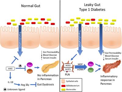 dysbiosis a gi-ben