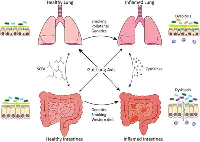 Frontiers Links Between Inflammatory Bowel Disease And Chronic Obstructive Pulmonary Disease Immunology Frontiers Links Between Inflammatory Bowel Disease And Chronic Obstructive Pulmonary Disease Immunology