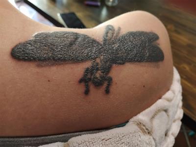 Sarcoid reaction in a seahorse tatoo on the deltoid skin  Download  Scientific Diagram