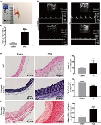 Frontiers Identification Of Transcriptional Variation In Aortic Remodeling Using A Murine Transverse Aortic Constriction Tac Model Cardiovascular Medicine