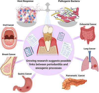 Risk Factors for Oral Cancer