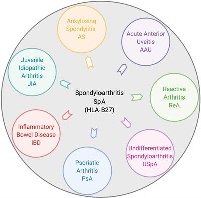 juvenile rheumatoid arthritis hla b27 dureri articulare la unguent pentru copii