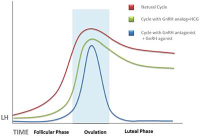 Frontiers  Luteal Phase in Assisted Reproductive Technology