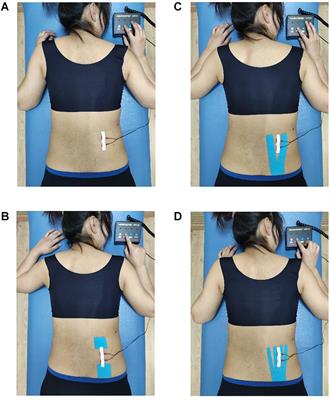 Frontiers  Effect of Different Kinesio Taping Interventions on