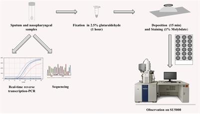 Frontiers Rapid Scanning Electron Microscopy Detection And Sequencing Of Severe Acute Respiratory Syndrome Coronavirus 2 And Other Respiratory Viruses Microbiology Frontiers Rapid Scanning Electron Microscopy Detection And Sequencing Of Severe Acute Respiratory Syndrome Coronavirus 2 And Other Respiratory Viruses Microbiology