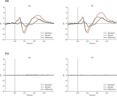 No Detectable Electroencephalographic Activity 24-hours After Clinical Declaration of Death among Tibetan Buddhist Meditators in apparent tukdam, a putative postmortem meditation state