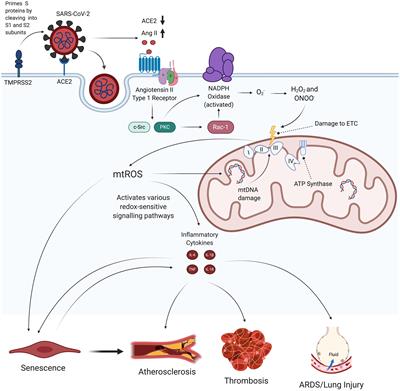 Endothelial cell infection and endotheliitis in COVID-19 - The Lancet
