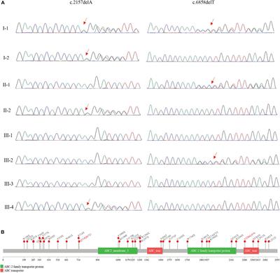 Frontiers Case Report Prenatal Diagnosis Of A Fetus With Harlequin Ichthyosis Identifies Novel Compound Heterozygous Variants A Case Report Genetics Frontiers Case Report Prenatal Diagnosis Of A Fetus With Harlequin Ichthyosis Identifies Novel Compound Heterozygous Variants A Case Report Genetics