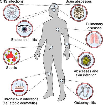 Molecular Pathogenesis of Staphylococcus aureus Infection