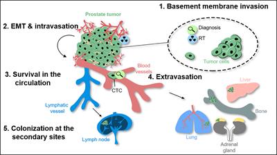 Cancer highly aggressive. Traducere 