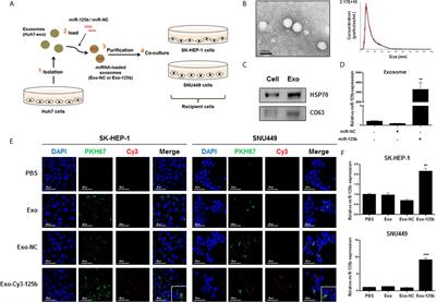 Exosomal Mir 125b Exerts Anti Metastatic Properties And Predicts Early Metastasis Of Hepatocellular Carcinoma Oncology Frontiers Exosomal Mir 125b Exerts Anti Metastatic Properties And Predicts Early Metastasis Of Hepatocellular Carcinoma Oncology Frontiers
