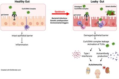 Frontiers Microbiome Or Infections Amyloid Containing Biofilms As A Trigger For Complex Human Diseases Immunology Frontiers Microbiome Or Infections Amyloid Containing Biofilms As A Trigger For Complex Human Diseases Immunology