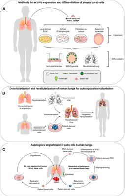 Lung extracellular matrix modulates KRT5+ basal cell activity in pulmonary  fibrosis