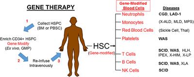 what is scid deficicency