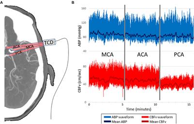 Frontiers Differentiating Dynamic Cerebral Autoregulation Across Vascular Territories