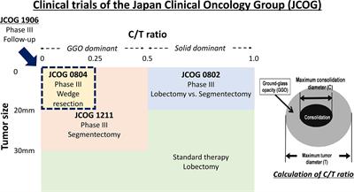 Transition of Treatment for Ground Glass Opacity–Dominant Non-Small Cell Lung Cancer