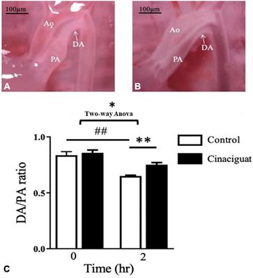 Frontiers Cinaciguat Prevents Postnatal Closure Of Ductus Arteriosus By Vasodilation And Anti Remodeling In Neonatal Rats Physiology Frontiers Cinaciguat Prevents Postnatal Closure Of Ductus Arteriosus By Vasodilation And Anti Remodeling In Neonatal Rats Physiology