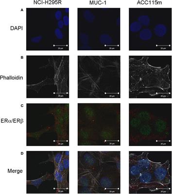 frontiers cytotoxic effect of progesterone tamoxifen and their combination in experimental cell models of human adrenocortical cancer endocrinology