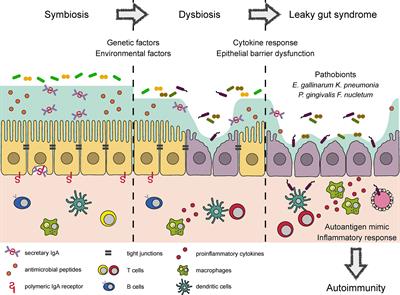 dysbiosis and leaky gut