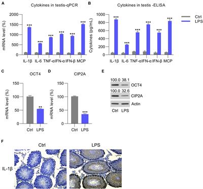 Morphology of Leydig cells in the testes after in vivo MCP-1 treatment.