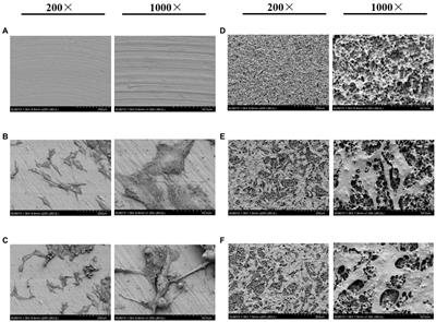 Frontiers  Impact of High-Altitude Hypoxia on Bone Defect Repair