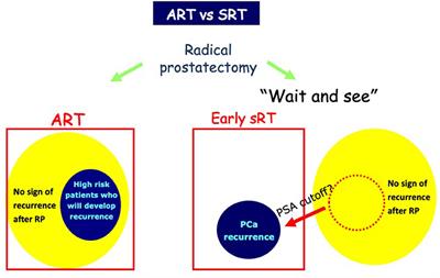 Frontiers | Radiation Therapy After Radical Prostatectomy: What Has Changed  Over Time?