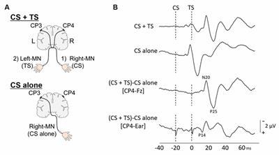 Somatosensory evoked potentials wiki