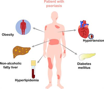 psoriasis introduction