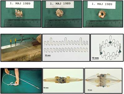 Frontiers How Transcatheter Aortic Valve Implantation Tavi Was Born The Struggle For A New Invention