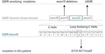 Frontiers | Case Report: Osimertinib Followed by Osimertinib Plus ...
