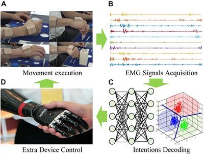 Electromyographic evaluation of upper limb muscles involved in armwrestling  sport simulation during dynamic and static conditions - ScienceDirect