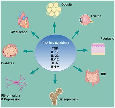 Frontiers Extra Articular Manifestations And Comorbidities In Psoriatic Disease A Journey Into The Immunologic Crosstalk Medicine