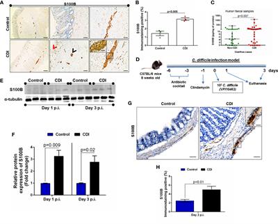 Frontiers S100b Inhibition Attenuates Intestinal Damage And Diarrhea Severity During Clostridioides Difficile Infection By Modulating Inflammatory Response Cellular And Infection Microbiology Frontiers S100b Inhibition Attenuates Intestinal Damage And Diarrhea Severity During Clostridioides Difficile Infection By Modulating Inflammatory Response Cellular And Infection Microbiology