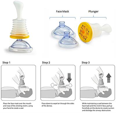 Frontiers  Use of a Novel Portable Non-powered Suction Device in Patients  With Oropharyngeal Dysphagia During a Choking Emergency