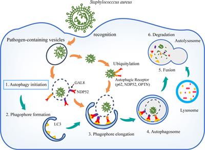 Frontiers  Selective Host Cell Death by Staphylococcus aureus: A Strategy  for Bacterial Persistence