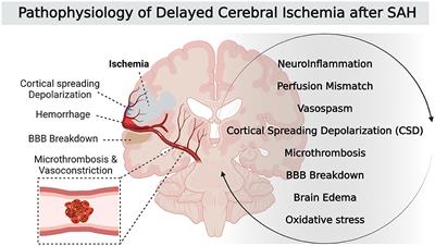 Frontiers  Delayed Cerebral Ischemia After Subarachnoid