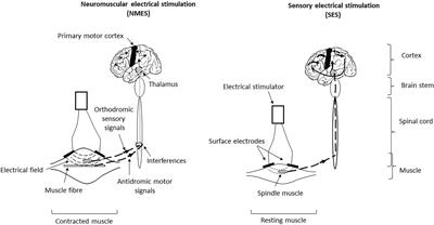 Modulation of spinal excitability following neuromuscular electrical  stimulation superimposed to voluntary contraction