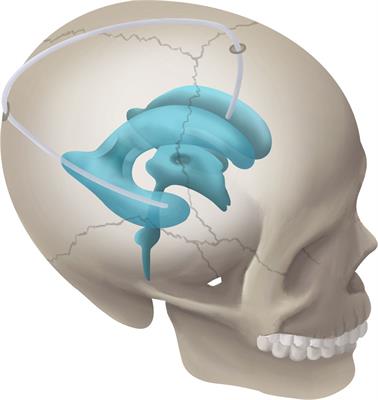 overshot jaw human made in china