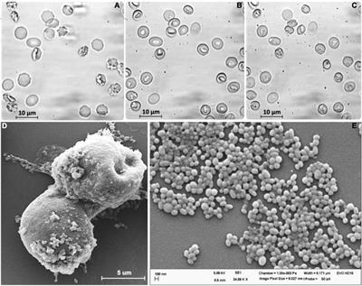 Frontiers | The Relation Between Extracellular Vesicles Released From Red Blood Cells, Their Cargo, and the Clearance by Macrophages Frontiers | The Relation Between Extracellular Vesicles Released From Red Blood Cells, Their Cargo, and the Clearance by Macrophages