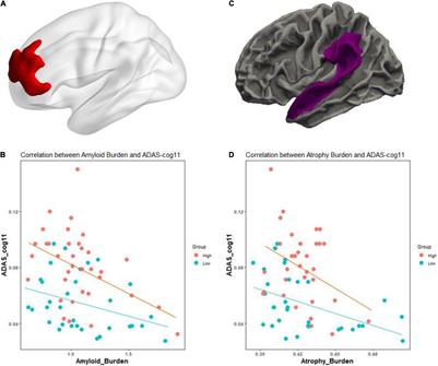 What is 'cognitive reserve'? How we can protect our brains from