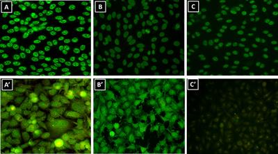 Frontiers Interkit Reproducibility Of The Indirect Immunofluorescence Assay On Hep 2 Cells Depends On The Immunofluorescence Reactivity Intensity And Pattern Immunology