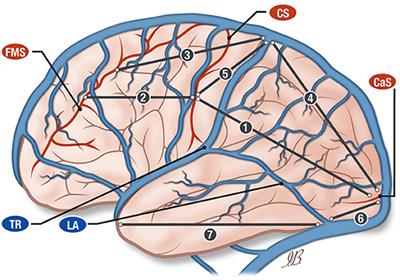 The larger superficial cerebral veins, including those draining the