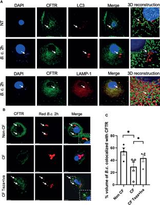 Frontiers Cftr Modulators Restore Acidification Of Autophago Lysosomes And Bacterial Clearance In Cystic Fibrosis Macrophages