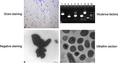 Frontiers | A Virulent Trueperella pyogenes Isolate, Which Causes Severe  Bronchoconstriction in Porcine Precision-Cut Lung Slices