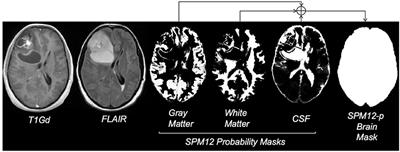 Frontiers  Automated Skull Stripping in Mouse Functional Magnetic  Resonance Imaging Analysis Using 3D U-Net