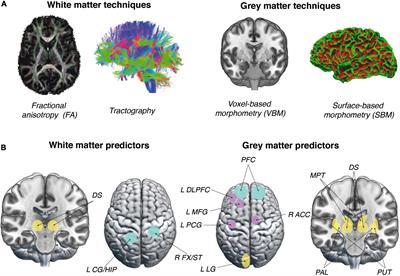 Video games can enhance decision-making skills, brain imaging study finds