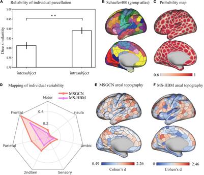 Distribution of intersubject variability in the masked