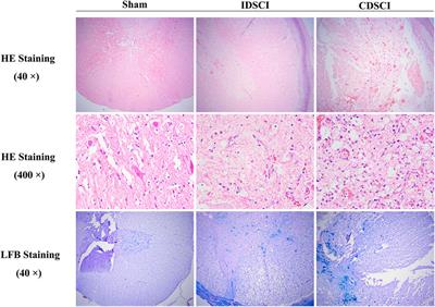 Frontiers | Elucidating the Potential Mechanisms Underlying Distraction Spinal  Cord Injury-Associated Neuroinflammation and Apoptosis