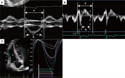 Evaluation of Right Ventricular Function and Dyssynchrony in a Dog Model of Acute Pulmonary Embolism: Diagnostic Utility and Reversibility - Frontiers Evaluation of Right Ventricular Function and Dyssynchrony in a Dog Model of Acute Pulmonary Embolism: Diagnostic Utility and Reversibility - Frontiers